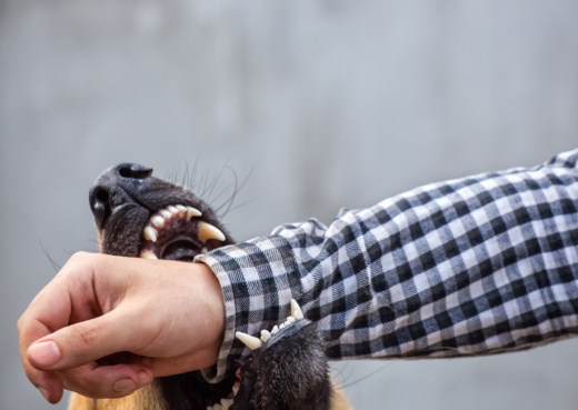 Dog biting a man's arm