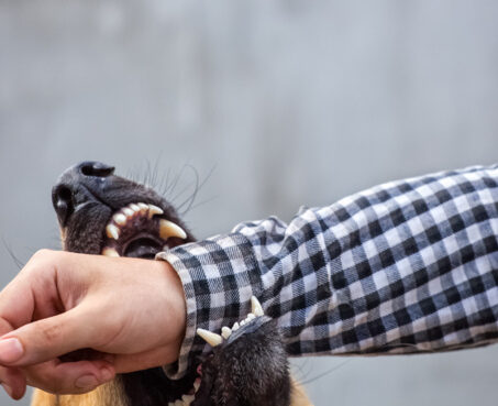 dog biting man's arm