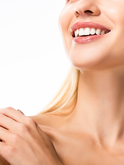 woman smiling with dental veneers