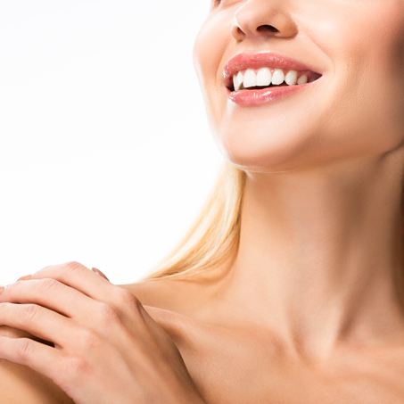 woman smiling with dental veneers
