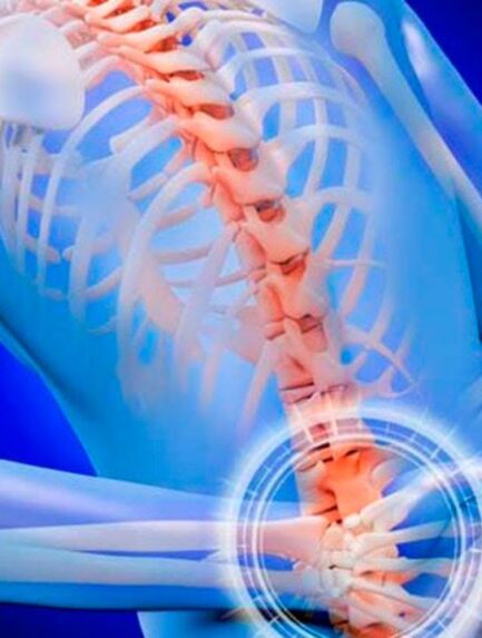 Apollo Soft Tissue and Spine