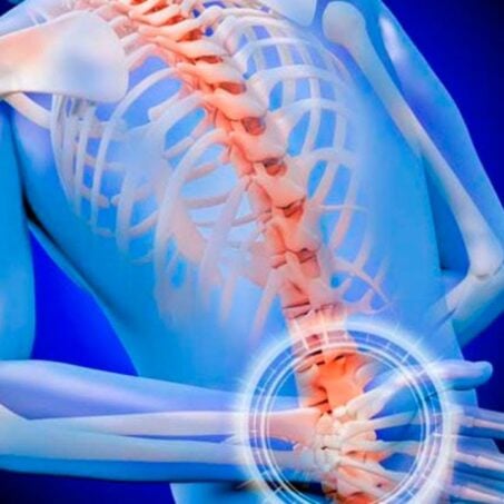 Apollo Soft Tissue and Spine