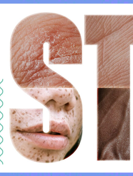Risk of Contracting an STI